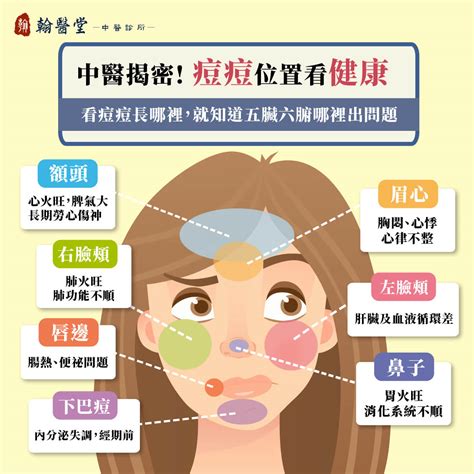 眉心長痘痘運勢|眉心痘痘預示何種桃花運？